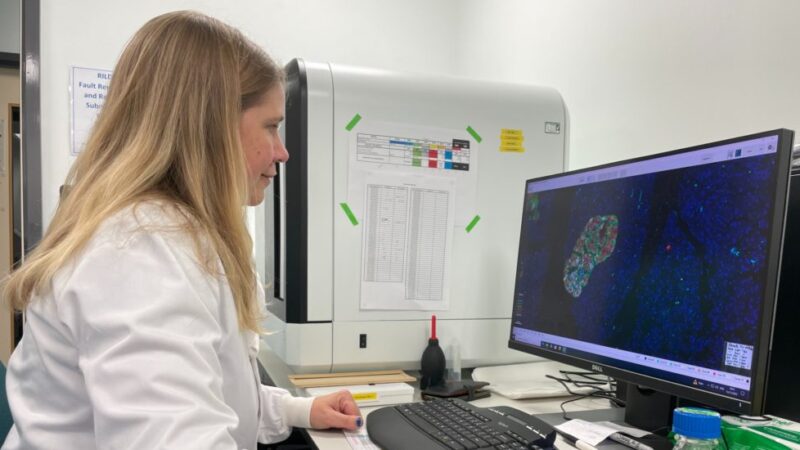 GW4 Researcher awarded £1.5 million for research into Type 1 Diabetes