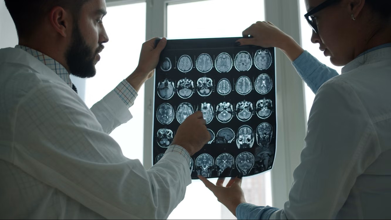 GW4 AI for Dementia Research Community thumbnail